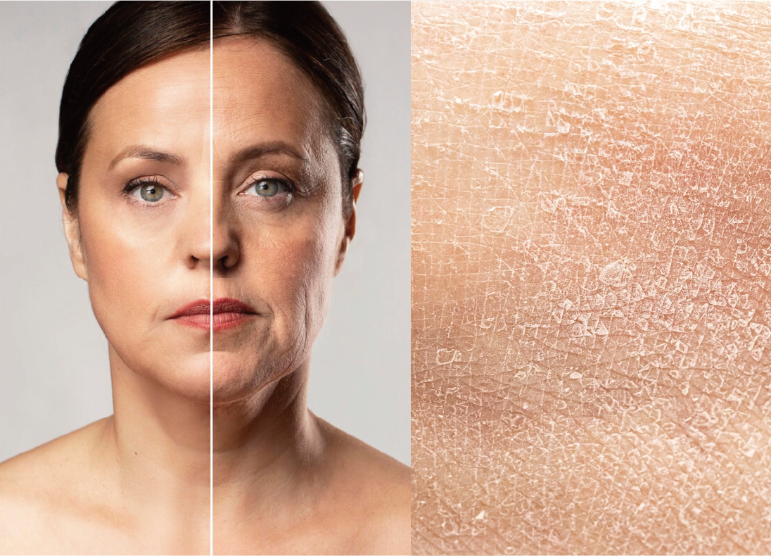 aging and dry skin course